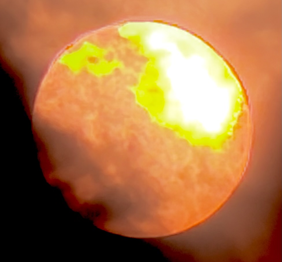 眠い太陽